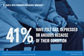 Of people with psoriasis considered 'moderate', 41% have felt sad, depressed or anxious because of their condition.