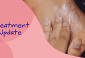 Treatment updates web banner_pink